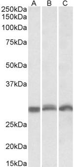 PSMA4 Antibody in Western Blot (WB)