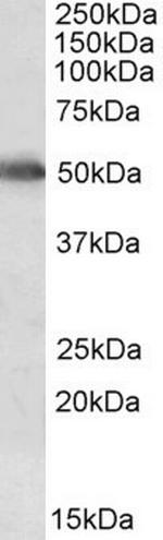 CYP2E1 Antibody in Western Blot (WB)