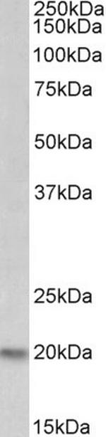 PSMB9 Antibody in Western Blot (WB)