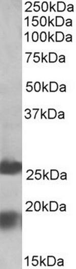 MPV17 Antibody in Western Blot (WB)