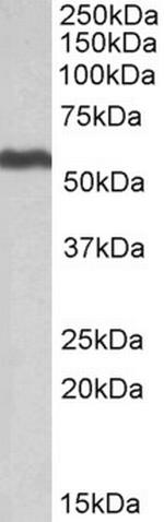 ALDH5A1 Antibody in Western Blot (WB)