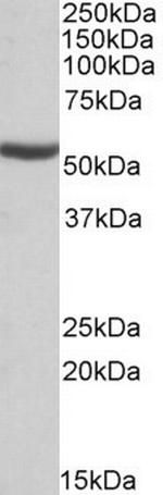 ALDH6A1 Antibody in Western Blot (WB)