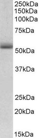 TRIM72 Antibody in Western Blot (WB)