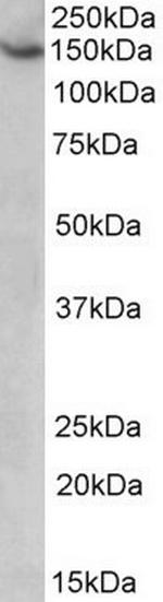 AGTPBP1 Antibody in Western Blot (WB)