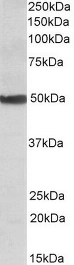 CYP24A1 Antibody in Western Blot (WB)