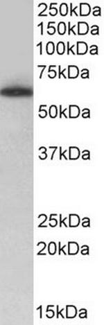 TH1L Antibody in Western Blot (WB)