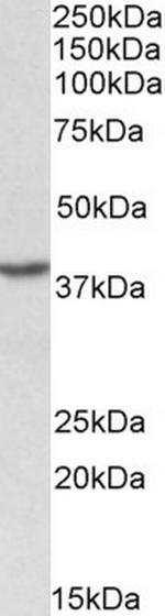 PCBP1 Antibody in Western Blot (WB)