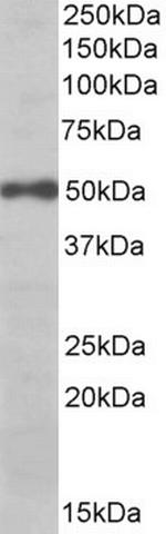 eIF3e Antibody in Western Blot (WB)