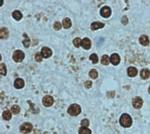 Lamin B1 Antibody in Immunohistochemistry (Paraffin) (IHC (P))