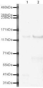 E-cadherin Antibody in Western Blot (WB)