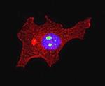 hnRNP K Antibody in Immunocytochemistry (ICC/IF)