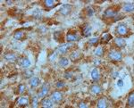 N-cadherin Antibody in Immunohistochemistry (Paraffin) (IHC (P))