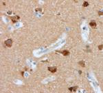 Nucleolin Antibody in Immunohistochemistry (Paraffin) (IHC (P))