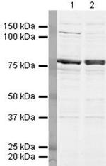 DDX17 Antibody in Western Blot (WB)