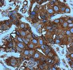 Cofilin Antibody in Immunohistochemistry (Paraffin) (IHC (P))