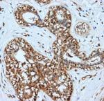 LDHA Antibody in Immunohistochemistry (Paraffin) (IHC (P))