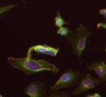 Kindlin Antibody in Immunocytochemistry (ICC/IF)