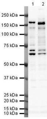 SMARCC2 Antibody in Western Blot (WB)