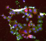 EpCAM Antibody in Immunocytochemistry (ICC/IF)