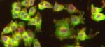 Gelsolin Antibody in Immunocytochemistry (ICC/IF)