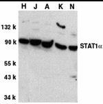 STAT1 Antibody in Western Blot (WB)