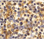 CCR3 Antibody in Immunohistochemistry (IHC)