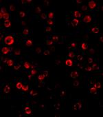 RAIDD Antibody in Immunocytochemistry (ICC/IF)