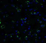 RAIDD Antibody in Immunocytochemistry (ICC/IF)