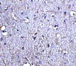 Neurturin Antibody in Immunohistochemistry (IHC)