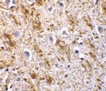 Neurturin Antibody in Immunohistochemistry (IHC)