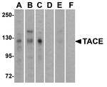 ADAM17 Antibody in Western Blot (WB)