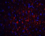 GFR alpha-1 Antibody in Immunohistochemistry (IHC)