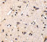 GFR alpha-1 Antibody in Immunohistochemistry (IHC)