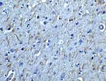 GFR alpha-1 Antibody in Immunohistochemistry (IHC)