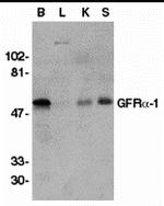 GFR alpha-1 Antibody in Western Blot (WB)