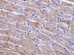 GFR alpha-3 Antibody in Immunohistochemistry (IHC)