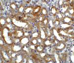 GFR alpha-3 Antibody in Immunohistochemistry (IHC)