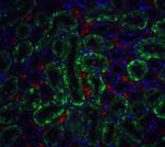 DFFB Antibody in Immunohistochemistry (IHC)