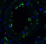 TRAIL-R2 (DR5) Antibody in Immunohistochemistry (Paraffin) (IHC (P))