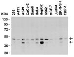 TRAIL-R2 (DR5) Antibody in Western Blot (WB)