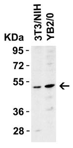 TRAIL-R2 (DR5) Antibody in Western Blot (WB)