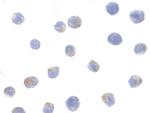 IKK alpha Antibody in Immunocytochemistry (ICC/IF)