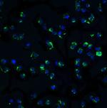 IKK alpha Antibody in Immunocytochemistry (ICC/IF)