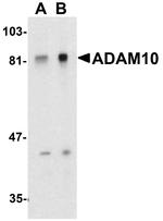 ADAM10 Antibody in Western Blot (WB)