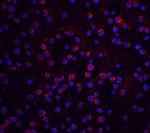 FLIP Antibody in Immunocytochemistry (ICC/IF)