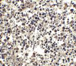 CIDEA Antibody in Immunohistochemistry (IHC)