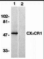 CX3CR1 Antibody in Western Blot (WB)