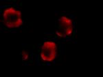 IRAK2 Antibody in Immunocytochemistry (ICC/IF)