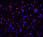 IRAK2 Antibody in Immunohistochemistry (IHC)