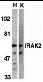 IRAK2 Antibody in Western Blot (WB)